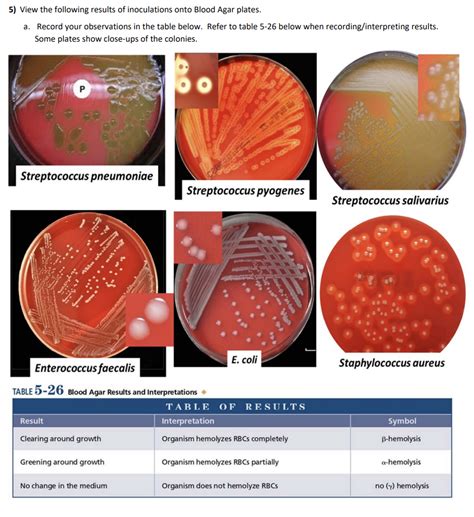 blood agar results interpretation